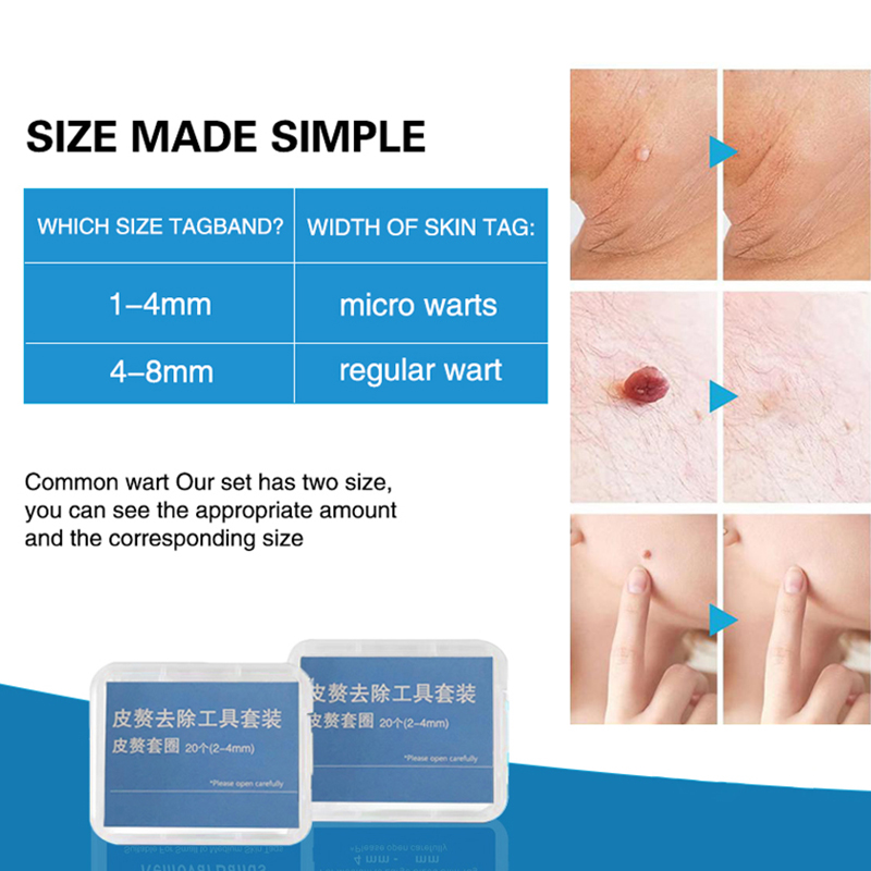 20pcs/Box Flesh Nevus Removal  - Power Tools Safety 评论和价格